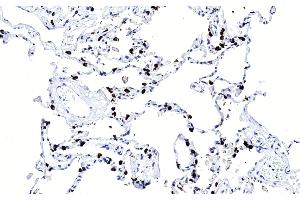 Immunohistochemical analysis of paraffin-embedded Human lung section using SFTPC Antibody (ABIN656267 and ABIN2845580). (Surfactant Protein C antibody  (N-Term))