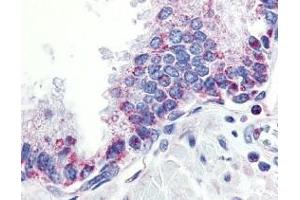 Immunohistochemistry of APRIL in human prostate tissue with APRIL antibody at 10 μg/ml.