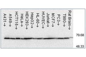 Western Blotting (WB) image for anti-Heat Shock Protein 70 (HSP70) antibody (ABIN263937) (HSP70 antibody)