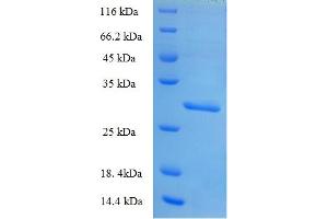 Nucleoredoxin-Like 2 (NXNL2) (AA 1-135), (full length) protein (His-SUMO Tag)