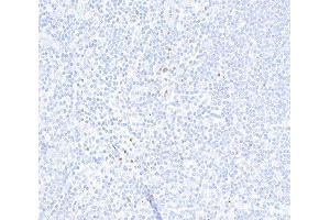 Immunohistochemistry (IHC) image for anti-Forkhead Box P3 (FOXP3) (AA 275-325) antibody (ABIN7455209) (Recombinant FOXP3 antibody  (AA 275-325))
