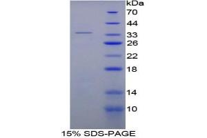 SDS-PAGE of Protein Standard from the Kit (Highly purified E. (SERPINC1 ELISA Kit)