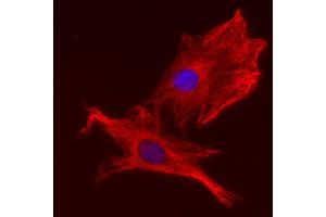 Immunocytochemistry (ICC) image for anti-alpha Tubulin (TUBA1) (AA 443-449) antibody (ABIN1742550)