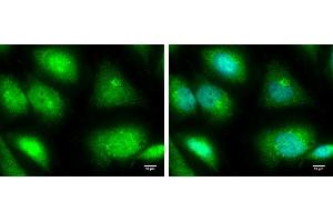 ICC/IF Image TRIM25 antibody [N2C1], Internal detects TRIM25 protein at cytoplasm and nucleus by immunofluorescent analysis. (TRIM25 antibody)