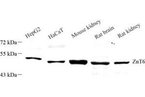 Western blot analysis of Znt6 (ABIN7075673),at dilution of 1: 1000 (SLC30A6 antibody)