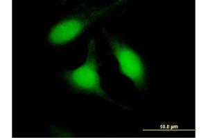 Immunofluorescence of purified MaxPab antibody to PSME2 on HeLa cell. (PSME2 antibody  (AA 1-239))