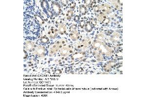 Immunohistochemistry (IHC) image for anti-Calcium Channel, Voltage-Dependent, beta 1 Subunit (CACNB1) (Middle Region) antibody (ABIN2776353)