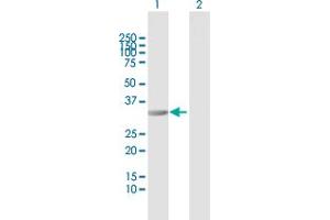 Western Blot analysis of RIMKLB expression in transfected 293T cell line by RIMKLB MaxPab polyclonal antibody. (RIMKLB antibody  (AA 1-307))
