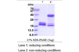 SDS-PAGE (SDS) image for Killer Cell Lectin-Like Receptor Subfamily D, Member 1 (KLRD1) (AA 32-179) protein (His tag) (ABIN6388105) (CD94 Protein (AA 32-179) (His tag))