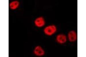 ABIN6275860 staining HepG2 by IF/ICC. (VRK3 antibody  (Internal Region))