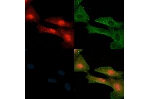 ABIN6258843 and ABIN6274212 staining  cells(H2O2 treatment) by IF/ICC.