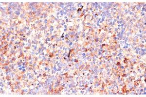 Immunohistochemistry of paraffin-embedded Mouse spleen using IL4R Polyclonal Antibody at dilution of 1:100 (40x lens). (IL4 Receptor antibody)