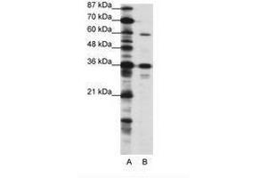 Image no. 1 for anti-CAMP Responsive Element Binding Protein 3-Like 1 (CREB3L1) (N-Term) antibody (ABIN202706) (CREB3L1 antibody  (N-Term))