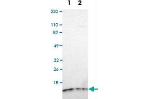 Western Blot analysis of Lane 1: RT-4 and Lane 2: U-251MG sp cell lysates with TIMM8A polyclonal antibody . (TIMM8A/DDP antibody)