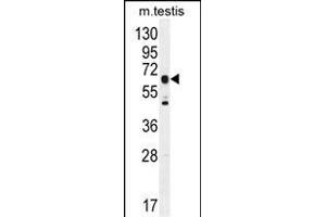 C19orf51 Antibody (Center) (ABIN6244201 and ABIN6577320) western blot analysis in mouse testis tissue lysates (35 μg/lane). (DNAAF3 antibody  (AA 181-210))