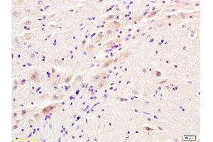 Formalin-fixed and rat brain tissue labeled with Anti-ADRA2 Polyclonal Antibody, Unconjugated  at 1:200 followed by conjugation to the secondary antibody and DAB staining (ADRA2A antibody  (AA 385-450))
