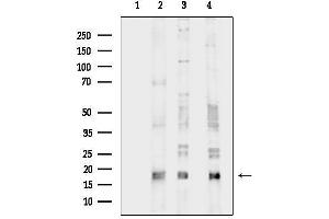 anti-Interleukin 17A (IL17A) (Internal Region) antibody