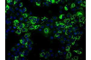 Anti-ALDH2 mouse monoclonal antibody (ABIN2452752) immunofluorescent staining of COS7 cells transiently transfected by pCMV6-ENTRY ALDH2 (RC200505). (ALDH2 antibody)