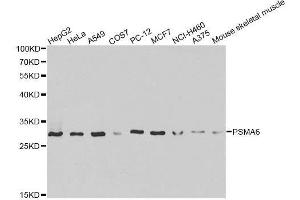 Western blot analysis of extracts of various cell lines, using PSMA6 antibody.