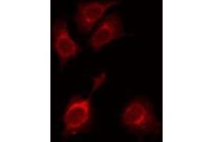 ABIN6275568 staining HuvEc by IF/ICC. (SH3RF3 antibody  (C-Term))