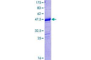 Image no. 1 for Gametocyte Specific Factor 1-Like (GTSF1L) (AA 1-148) protein (GST tag) (ABIN1306198) (GTSF1L Protein (AA 1-148) (GST tag))