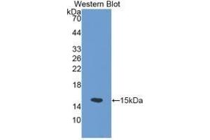 Detection of Recombinant SLC30A5, Mouse using Polyclonal Antibody to Solute Carrier Family 30, Member 5 (SLC30A5)