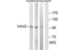 Western Blotting (WB) image for anti-Vav 2 Guanine Nucleotide Exchange Factor (VAV2) (AA 108-157) antibody (ABIN2888936) (VAV2 antibody  (AA 108-157))