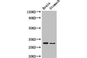 Western Blot Positive WB detected in: Mouse brain tissue, Mouse stomach tissue All lanes: COPS7B antibody at 3 μg/mL Secondary Goat polyclonal to rabbit IgG at 1/50000 dilution Predicted band size: 30, 19, 31 kDa Observed band size: 30 kDa (COPS7B antibody  (AA 1-157))