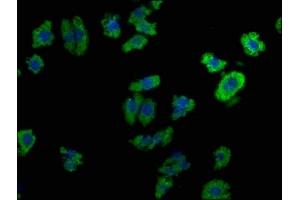 Immunofluorescence staining of HepG2 cells with ABIN7139920 at 1:100, counter-stained with DAPI. (LPAR6 antibody  (AA 292-313))
