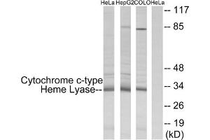Western blot analysis of extracts from HeLa cells, HepG2 cells and COLO cells, using Cytochrome c-type Heme Lyase antibody. (HCCS antibody  (Internal Region))