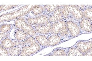 Detection of DAO in Human Kidney Tissue using Polyclonal Antibody to D-Amino Acid Oxidase (DAO) (D Amino Acid Oxidase antibody  (AA 1-347))