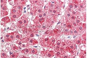 Rabbit Anti-ALDH3A2 antibody  Formalin Fixed Paraffin Embedded Tissue: Human Adult Adrenal  Observed Staining: Cytoplasm in hepatocytes Primary Antibody Concentration: 1:600 Secondary Antibody: Donkey anti-Rabbit-Cy3 Secondary Antibody Concentration: 1:200 Magnification: 20X Exposure Time: 0. (ALDH3A2 antibody  (Middle Region))