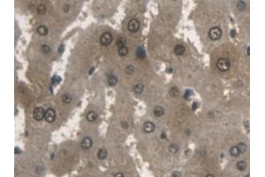 Immunohistochemistry (IHC) image for anti-Aldolase A, Fructose-Bisphosphate (ALDOA) (AA 18-273) antibody (ABIN7440131)