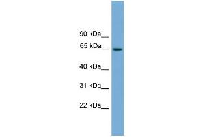 WB Suggested Anti-TRIM25 Antibody Titration: 0. (TRIM25 antibody  (Middle Region))