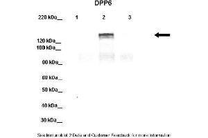 Lanes:   Lane 1: 20ug HEK-293 cell lysate Lane 2: 20ug hDPP6-YFP transfected HEK-293 lysate Lane 3: 20ug hDPP10-YFP transfected HEK-293 lysate  Primary Antibody Dilution:   1:1000  Secondary Antibody:   Donkey anti-rabbit-HRP  Secondary Antibody Dilution:   1:10,000  Gene Name:   DPP6 a  Submitted by:   Jeanne M. (DPP6 antibody  (Middle Region))