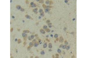 #VALUE! (CITED1 antibody  (AA 1-203))