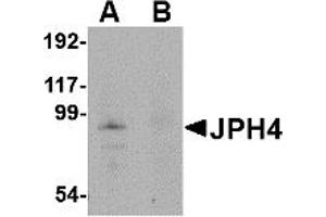 Western Blotting (WB) image for anti-Junctophilin 4 (JPH4) (Middle Region) antibody (ABIN1030971)
