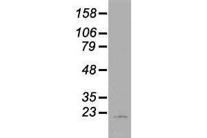 Western blot analysis of 35 µg of cell extracts from human (HeLa) cells using anti-AK1 antibody. (Adenylate Kinase 1 antibody)