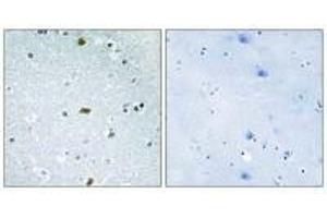 Immunohistochemistry analysis of paraffin-embedded human brain tissue, using ZFHX3 antibody. (ZFHX3 antibody)