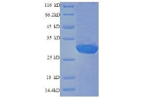 Endothelin 1 (EDN1) (AA 53-73), (full length) protein (GST tag)