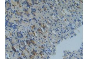 Detection of MMP14 in Mouse Stomach Tissue using Polyclonal Antibody to Matrix Metalloproteinase 14 (MMP14)