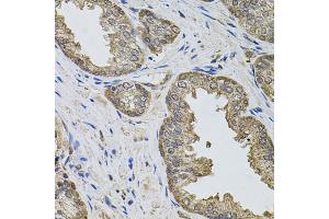 Immunohistochemistry of paraffin-embedded human prostate using IGSF3 antibody (ABIN5975786) (40x lens). (IGSF3 antibody)