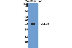 Western Blotting (WB) image for anti-Sialidase 1 (Lysosomal Sialidase) (NEU1) (AA 141-286) antibody (ABIN1174834) (NEU1 antibody  (AA 141-286))
