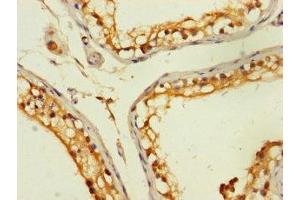 Immunohistochemistry of paraffin-embedded human testis tissue using ABIN7176385 at dilution of 1:100 (ZNF562 antibody  (AA 201-426))