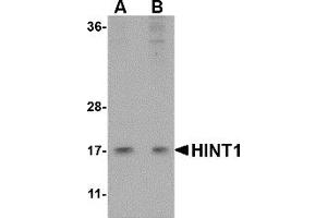 Western Blotting (WB) image for anti-Histidine Triad Nucleotide Binding Protein 1 (HINT1) (Middle Region) antibody (ABIN1030948) (HINT1 antibody  (Middle Region))