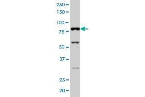 SFRS17A monoclonal antibody (M02), clone 2G8 Western Blot analysis of SFRS17A expression in Hela S3 NE .
