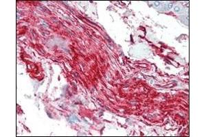 Immunohistochemical analysis of paraffin-embedded human nerve and ganglion cells using S100A10/P11 antibody. (S100A10 antibody)