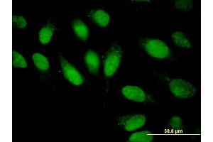 Immunofluorescence of monoclonal antibody to CMPK1 on HeLa cell. (Cytidine Monophosphate (UMP-CMP) Kinase 1, Cytosolic (CMPK1) (AA 1-228) antibody)