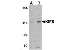 Image no. 1 for anti-Kinesin Family Member 5A (KIF5A) (Center) antibody (ABIN372915) (KIF5A antibody  (Center))