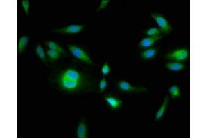 Immunofluorescence staining of Hela cells with ABIN7155077 at 1:133, counter-stained with DAPI. (HPS6 antibody  (AA 221-319))